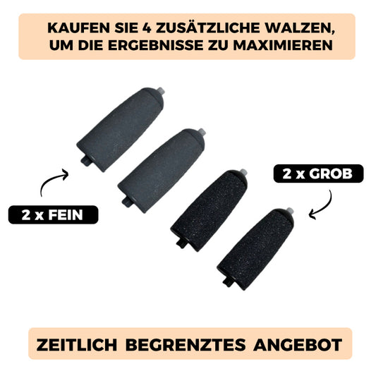 Hanna™ - Hornhautentferner Extra Walze